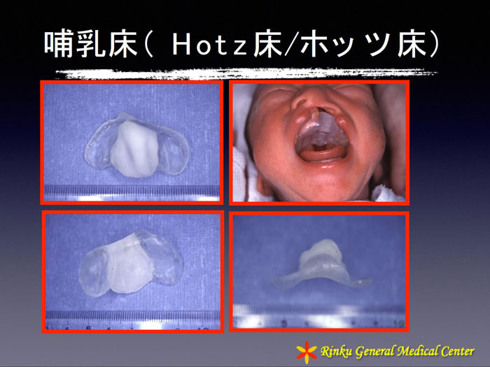 親知らず 抜歯 後 白い 塊