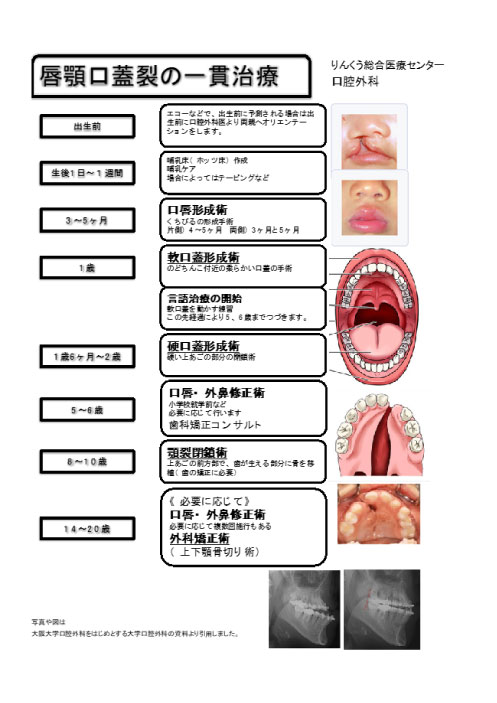 親知らず 抜歯 喉 痛い